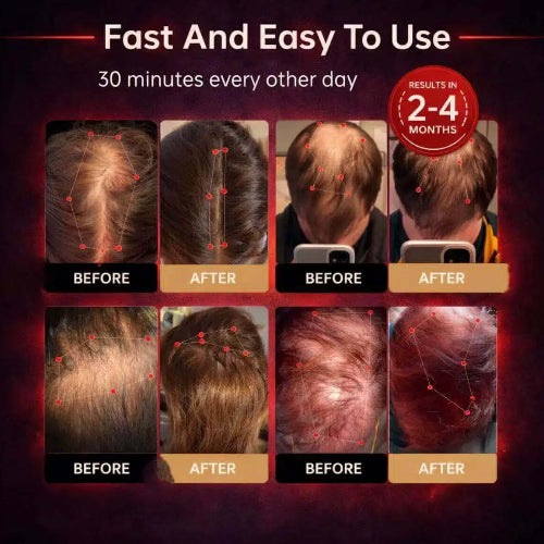 CROWN NOVA - Red Light Therapy Regrowth Cap